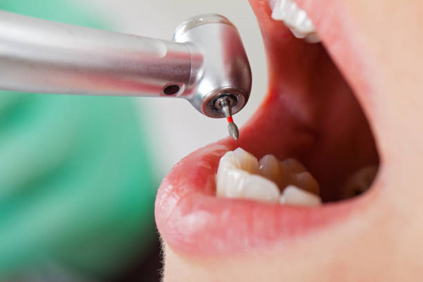 Best Pediatric Emergency Dentist in Stearns, KY